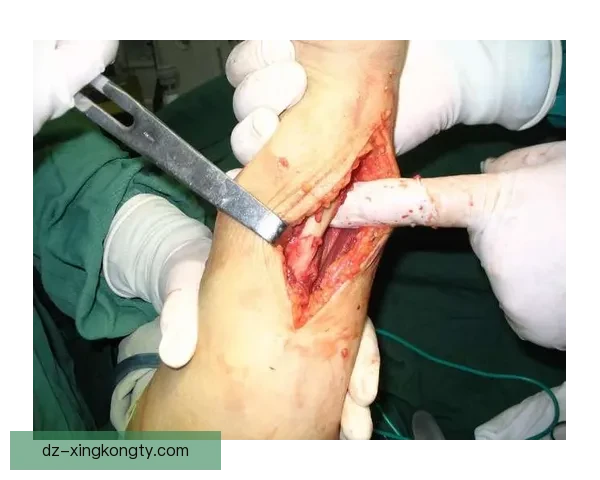 外媒称林赛沃恩骨折手术情况稳定 外媒称林赛沃恩骨折手术情况稳定